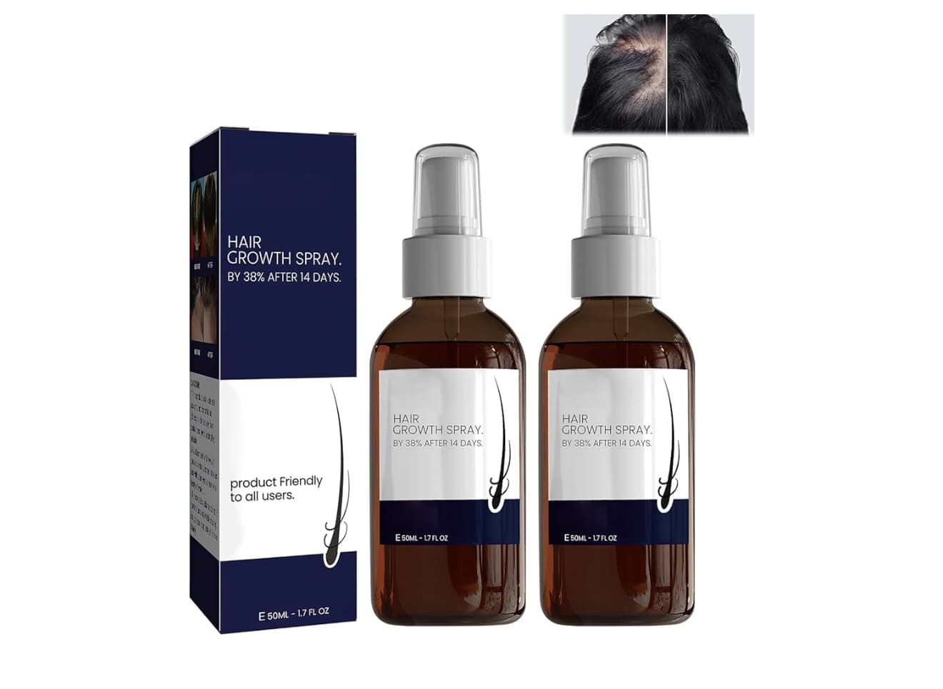 Ouhoe Hair Growth Spray and Serum